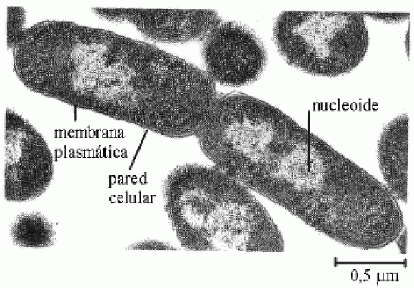 Bacteria a microscopio electrónico